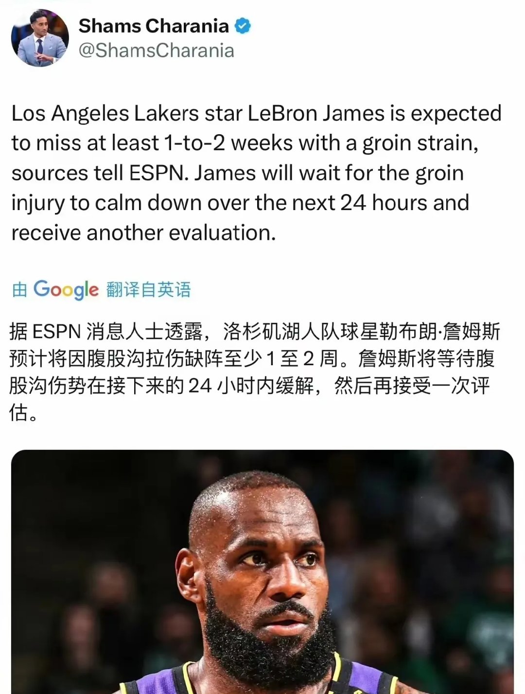 詹姆斯在FPX比赛中逆转，官方发布新规引发热议！